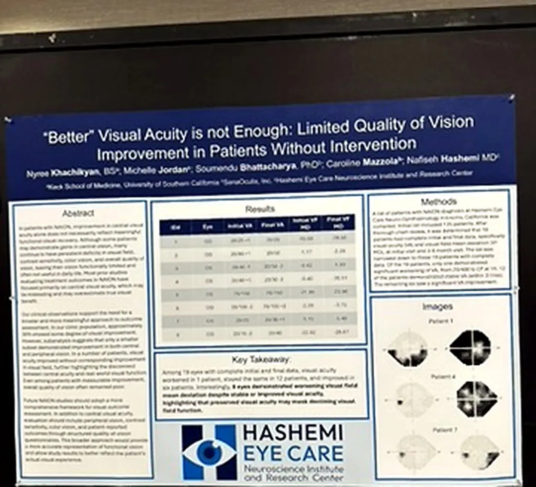 Hashemi Eye Care NANOS research poster about quality of vision improvement