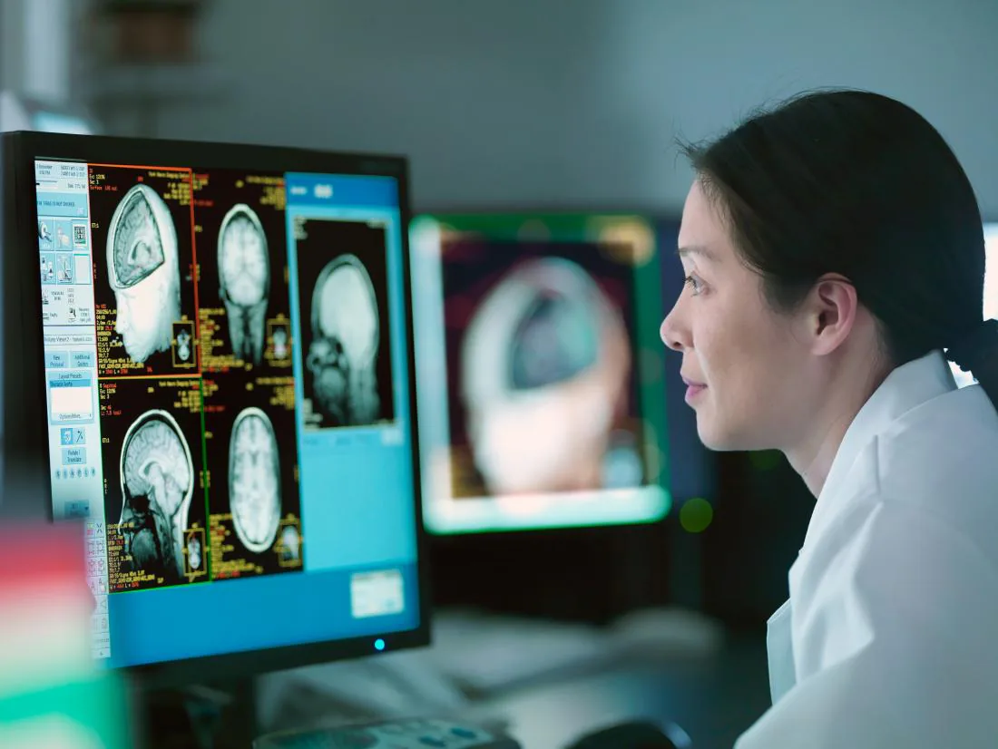 doctor looking at screen with MRI scans of a patient's brain