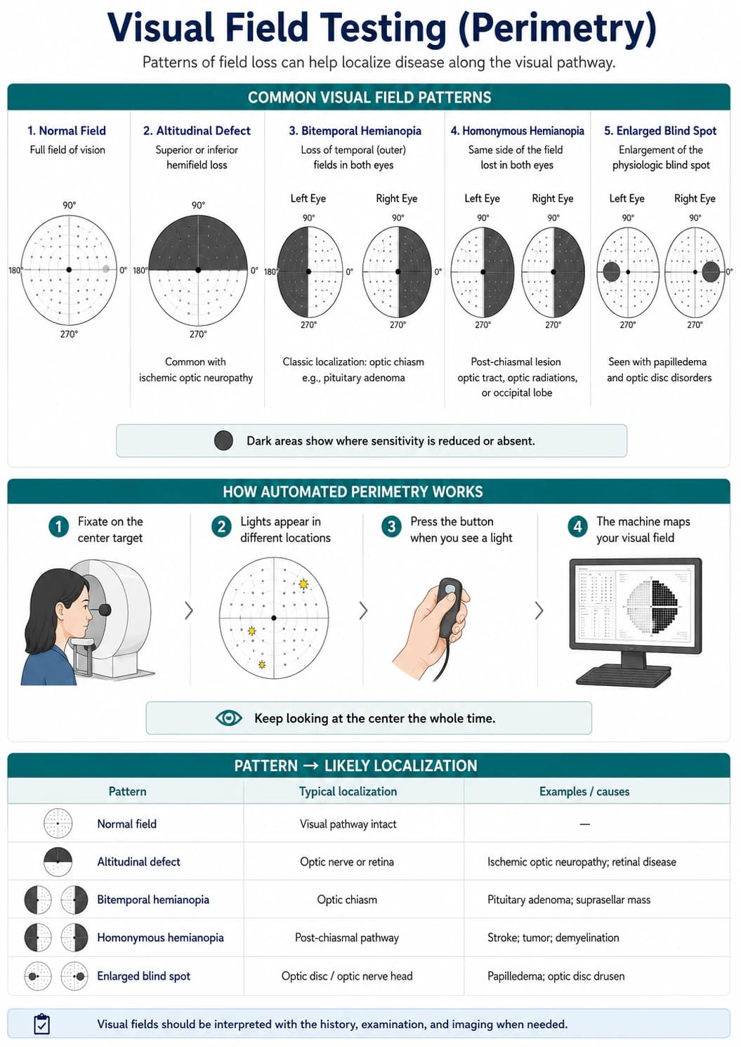 Infographic on visual field testing (perimetry): five example field patterns - normal, altitudinal defect, bitemporal hemianopia, homonymous hemianopia, and enlarged blind spot - shown eye by eye; a four-step diagram of automated perimetry showing fixation, appearing lights, button response, and machine mapping; and a lesion-localization table linking each pattern to the likely site along the visual pathway (optic nerve or retina, optic chiasm, post-chiasmal pathway, optic disc) and common causes such as ischemic optic neuropathy, pituitary adenoma, stroke, and papilledema