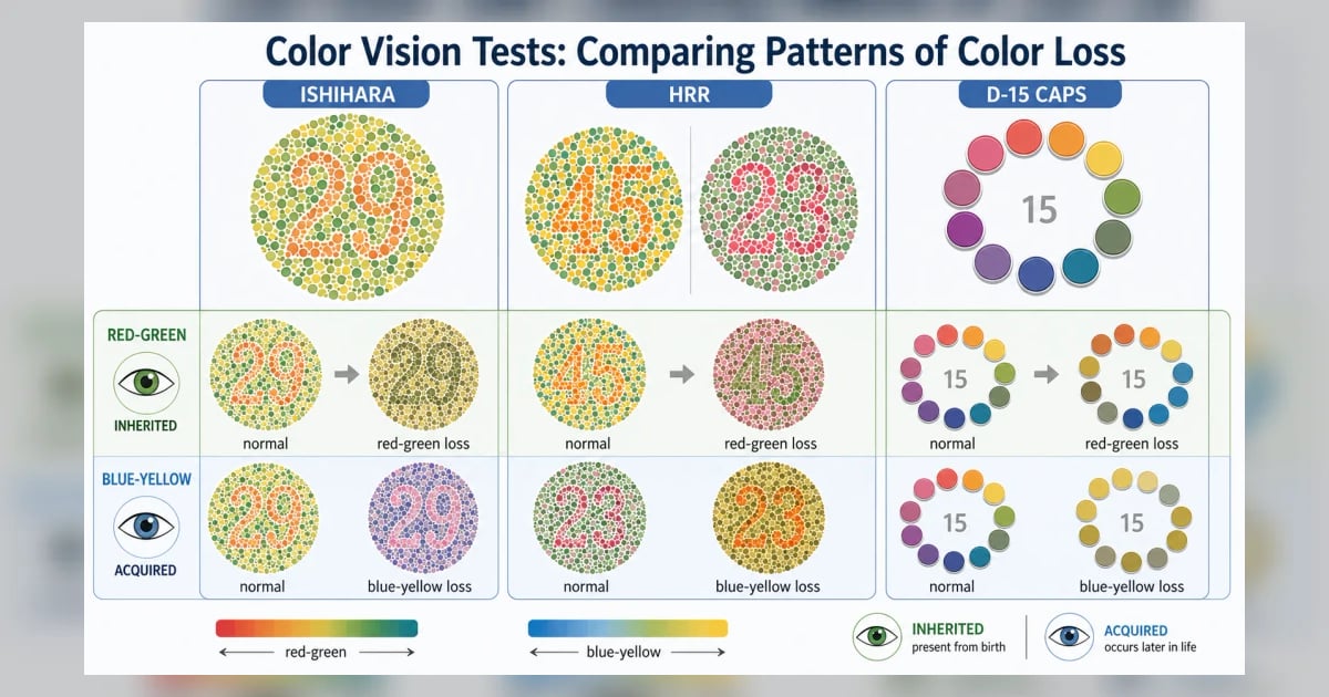 Ophthalmology Color Vision Testing Color Vision Test: Purpose, Types & What Results Mean | Hashemi Eye Care